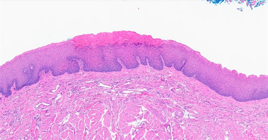 Salivary gland tissue