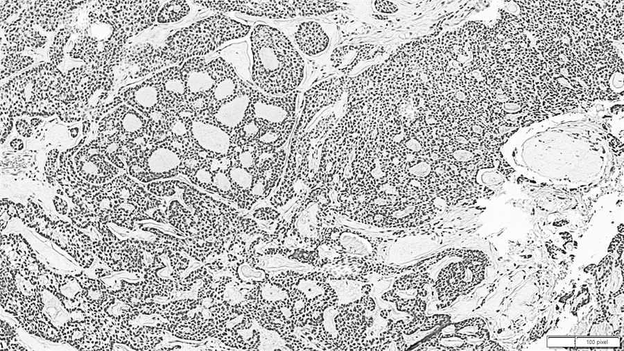 Immunohistochemical stain