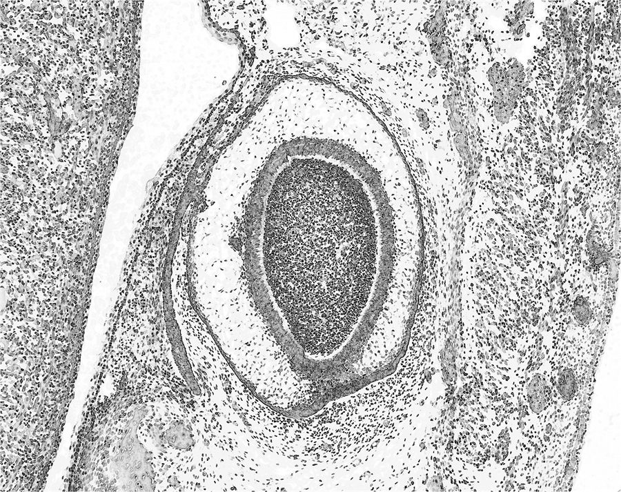 Papillary tissue architecture